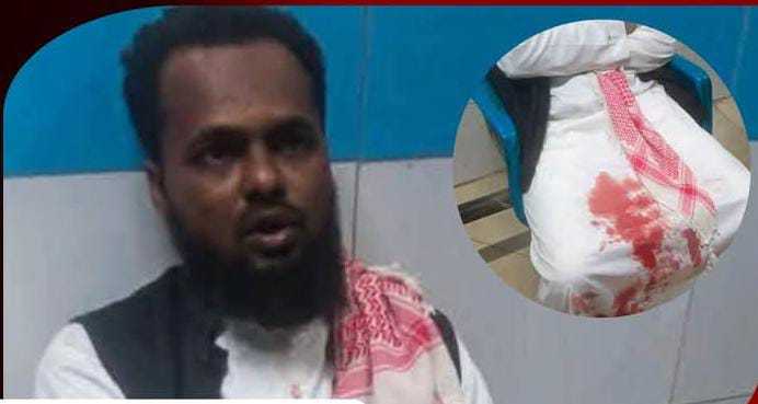 খুলনায় আবাসিক হোটেলে   মাদ্রাসা শিক্ষকের পুরুষাঙ্গ কেটে নিয়েছে এক নারী