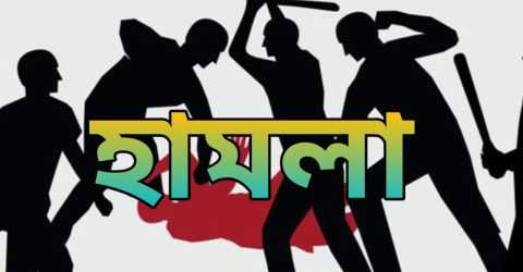 রংপুর মহানগর সিট উত্তম এলাকা পূর্ব শত্রুতার জের ধরে প্রতিপক্ষের হামলা, আহত- ২