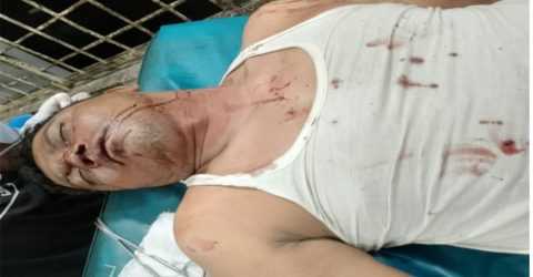 খুলনায় বিএনপি নেতার উপর সন্ত্রাসী হামলার অভিযোগ, হত্যার উদ্দেশ্যে কুপিয়ে জখম